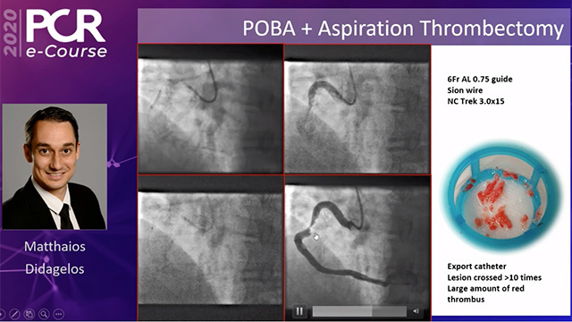 PCR e-Course Clinical cases