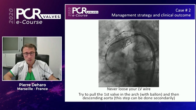 TAVI Complications