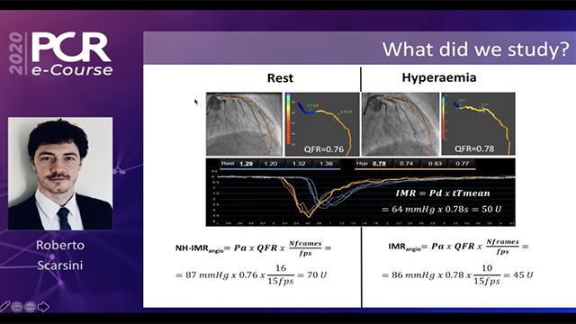 Physiology or intracoronary imaging; or both? or none?