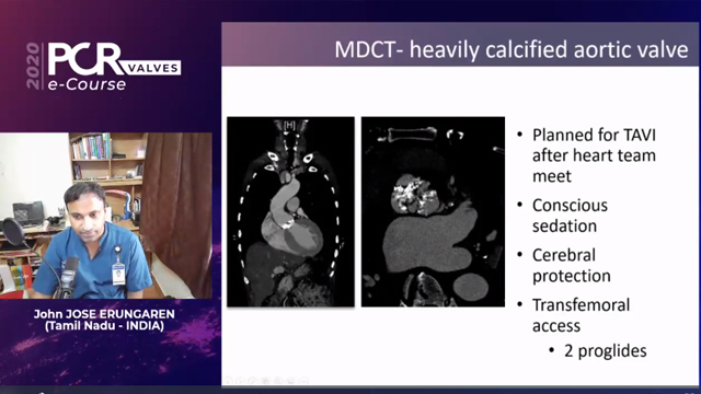 TAVI vascular access: Part 2