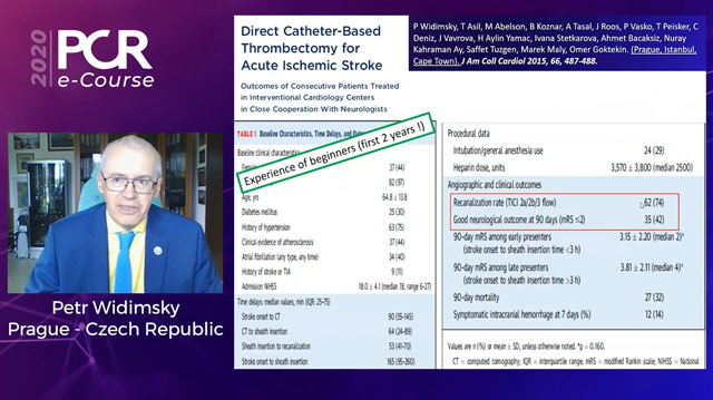 Update on interventional treatment of ischaemic stroke
