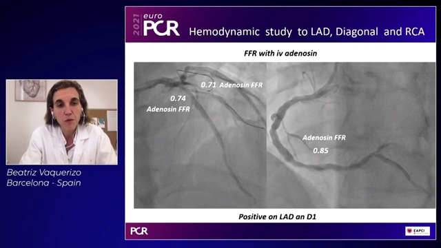 A case-based approach: finding balance between bleeding and ischemic risk