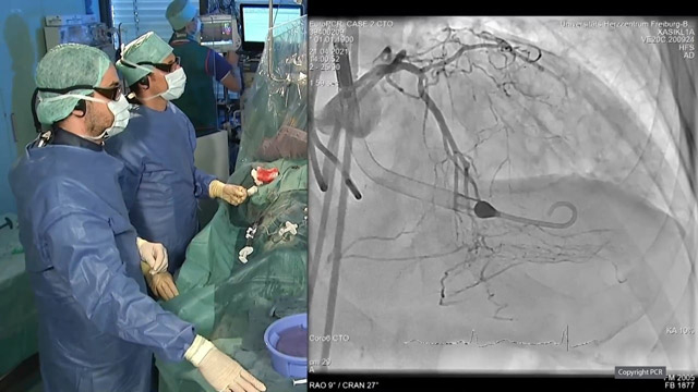 Advanced techniques for complex CTO interventions (Part 1)