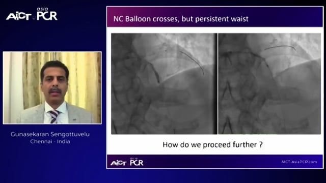 Calcified lesions: how to deal with it?