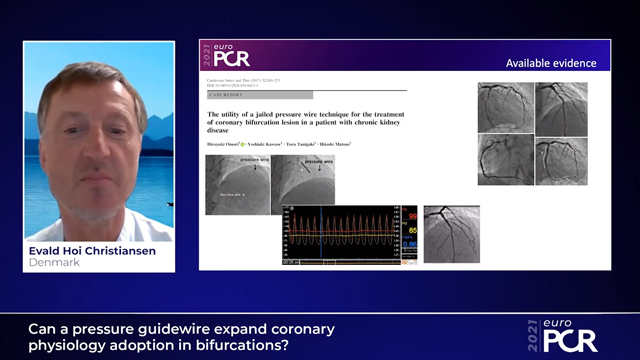 Can a pressure guidewire expand coronary physiology adoption in bifurcations?