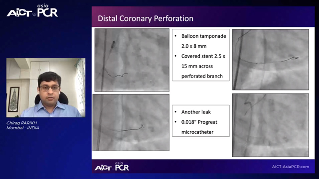 Cases on complications of coronary perforation