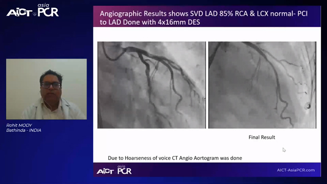 Cases on peripheral interventions - Endovascular
