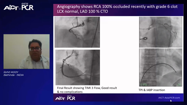 Cases on STEMI