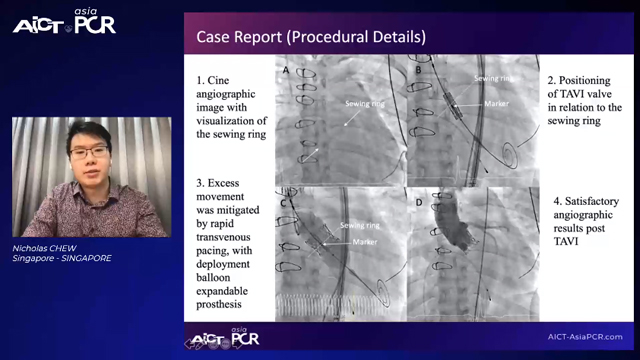 Cases on valvular disease