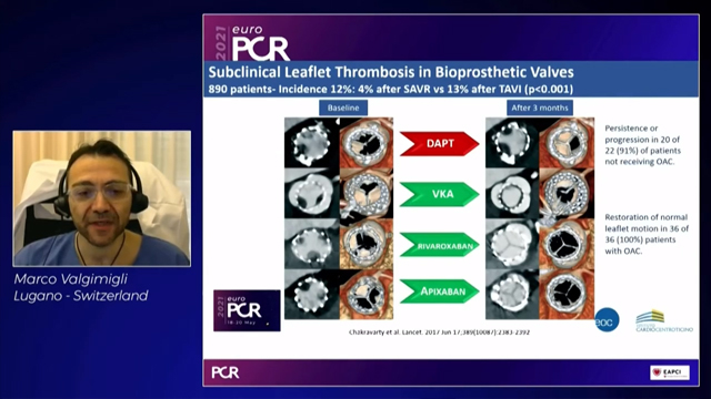 Challenges and opportunities in high-risk patients undergoing TAVI