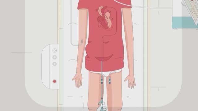 EAPCI: patient initiatives around the world