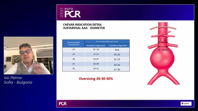 Endovascular aortic repair and case-based discussion of complications during peripheral interventions