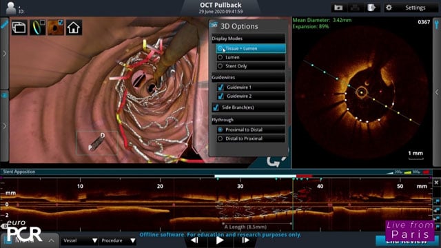 Clinical applications of IVUS, OCT and other intracoronary imaging techniques: practical simulation-based learning (Part 1)