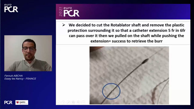 EuroPCR 2021 Complex rotational atherectomy