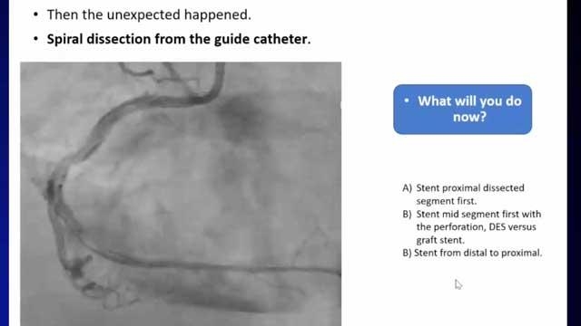 EuroPCR 2021 Complications: NSTEMI