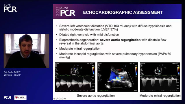 EuroPCR 2021 Coronary protection - Many roads lead to Rome