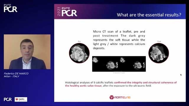 EuroPCR 2021 - Innovations in peripheral and structural interventions