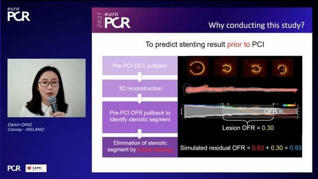 EuroPCR 2021 - Innovations in stable CAD