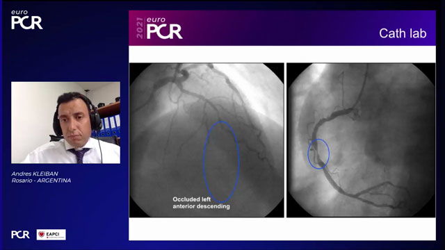 EuroPCR 2021 A mix of complications