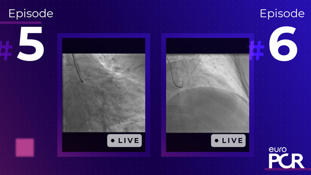 EAPCI-PCR Fellows Course 2021 - Coronary track: Ambiguous LM/PCI strategy for mid-LAD bifurcation
