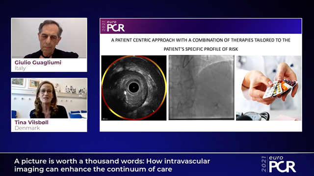 A picture is worth a thousand words: how intravascular imaging can enhance the continuum of care