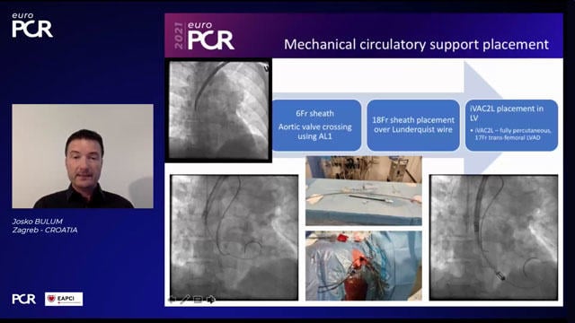 EuroPCR 2021 Challenging scenarios in STEMI patients