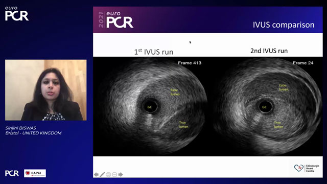 EuroPCR 2021 Coronary dissection - Part 1