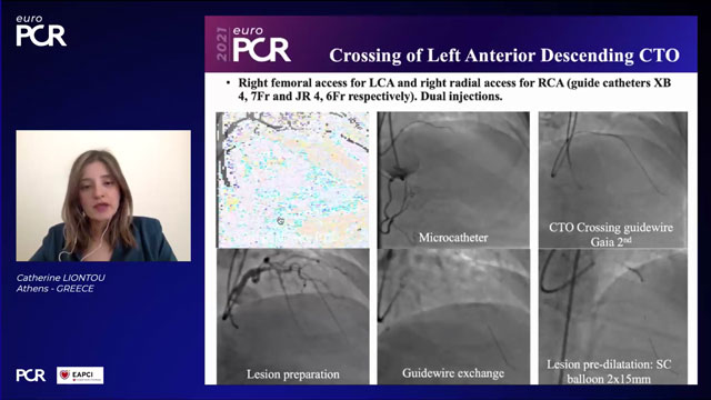EuroPCR 2021 CTO: imaging and devices