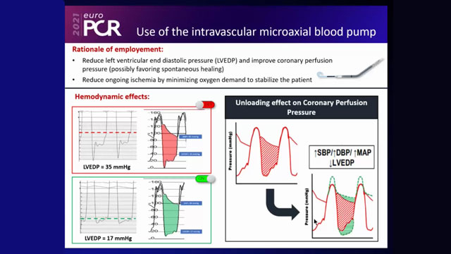 EuroPCR 2021 How to deal with spontaneous dissection?