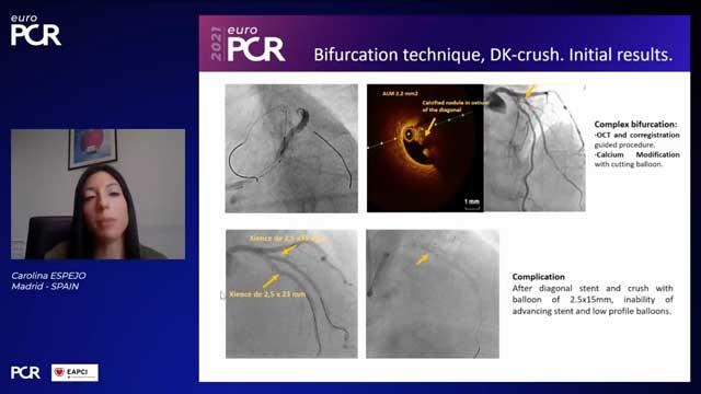 EuroPCR 2021 Thrombus horribilis