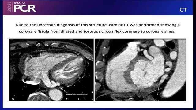 EuroPCR 2021 When vascular conduits deserve to be closed