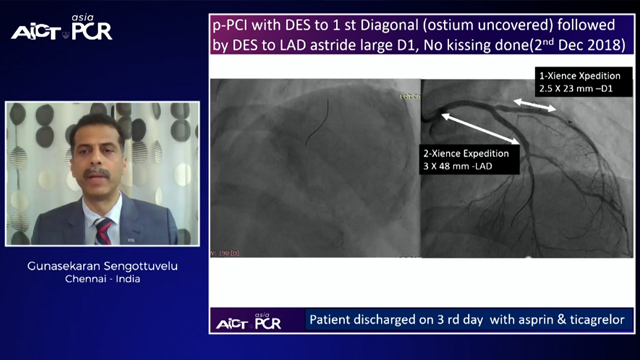 Imaging in stent thrombosis
