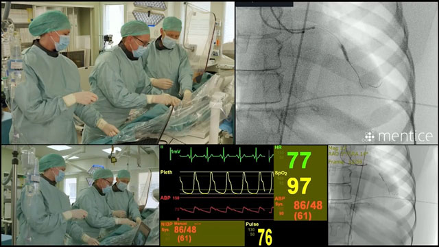 Managing acute coronary perforation: a simulation-based team approach