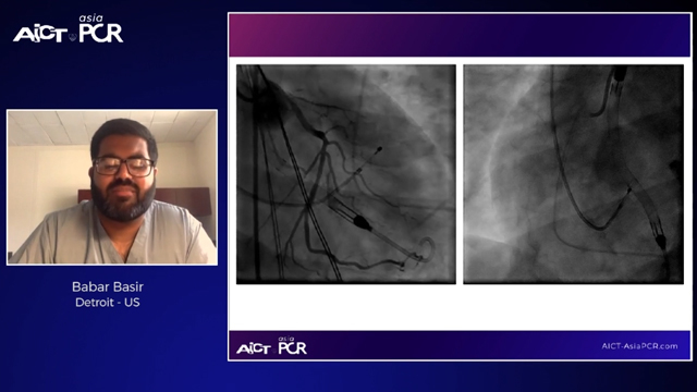 Mechanical circulatory support: which, how, when!