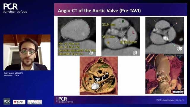 Unusual situations during TAVI