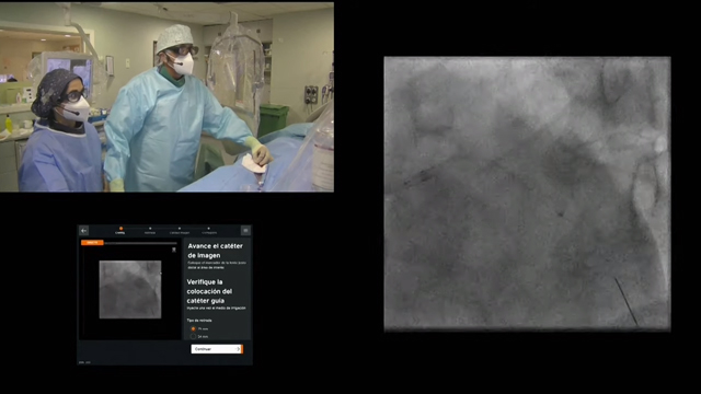 Modern PCI: how OCT, with the new ULTREON 1.0 software, supports you in guiding and optimising your procedure: a calcified lesion