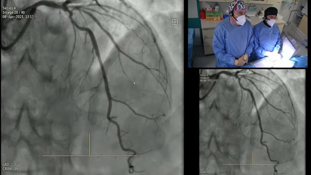 Multivessel disease revascularisation: balancing the risk
