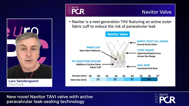 New, novel Navitor TAVI valve with active paravalvular leak-sealing technology
