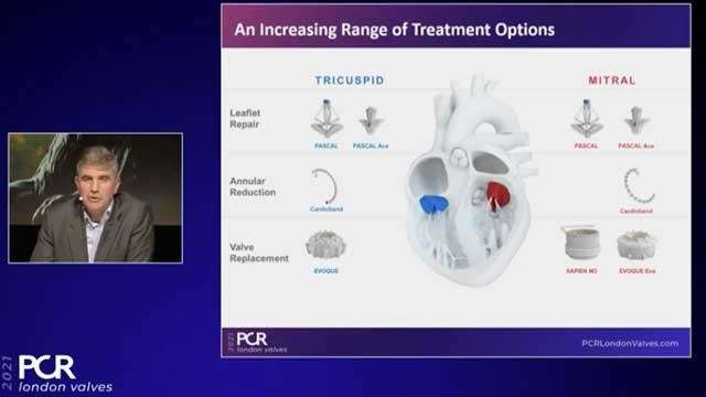 From TAVI to mitral and tricupid - Part 2 - Securing long-term patient options