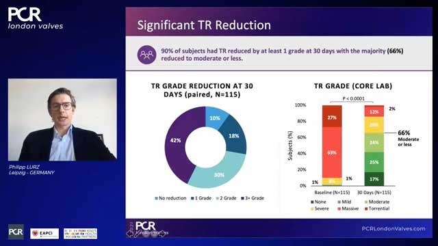 PCR London Valves 2021 Hotlines / Late-Breaking Trials: bRIGHT, EXPAND, CHOICE-MI