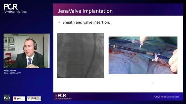 PCR London Valves 2021 Hotlines / Late-Breaking Trials: GALILEO, JenaValve TAVI,, ENVISAGE TAVI AF, VKA in patients with AF after TAVI