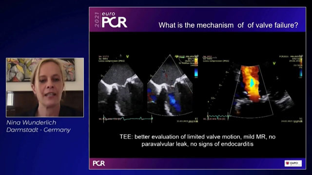 Percutaneous mitral treatment: replacement