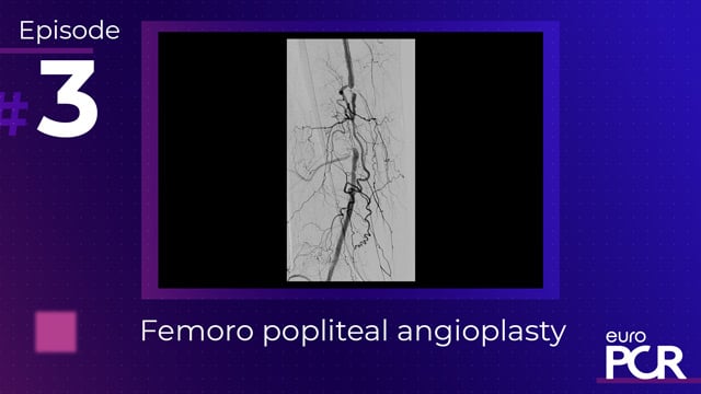 PCR Peripheral for beginners - Femoro popliteal angioplasty 