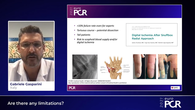 Re-evolution in PCI: distal radial approach