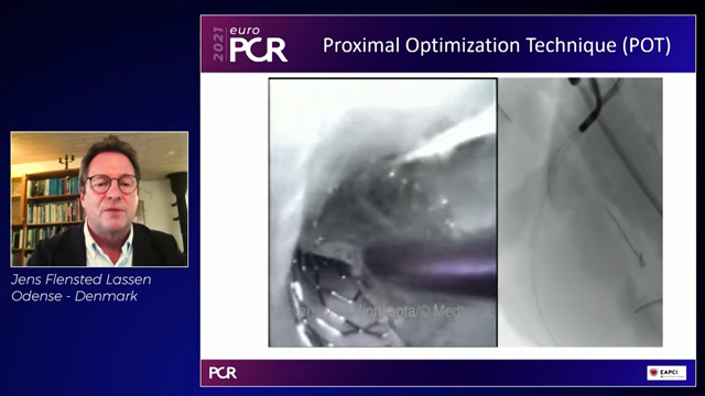 Single vs. two-stent techniques in left main: the impact of EBC MAIN