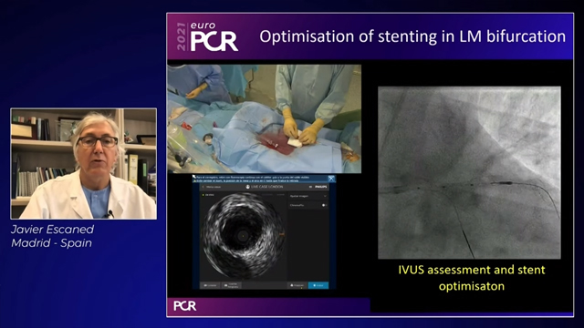 Ultra-low contrast 2021: new skills and technologies for next frontier in PCI