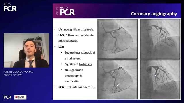 Uncrossable lesions