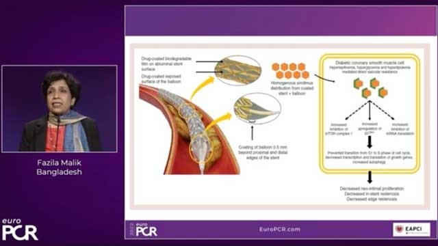 The ability to transform coronary artery disease treatment: innovative nanotechnology-based sirolimus DES and DCB platforms