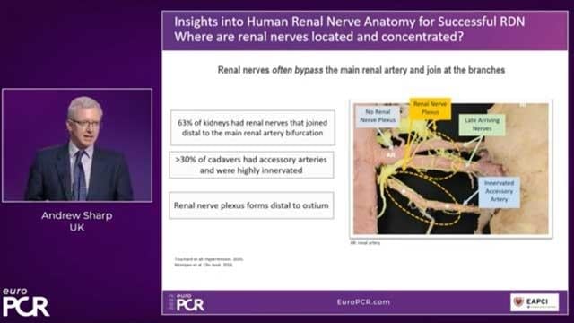 Advances in renal denervation: from patient selection to procedure