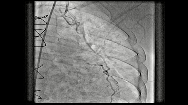 Challenging and complication cases